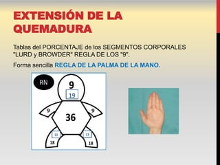 EXTENSIÓN DE LA
QUEMADURA
Tablas del PORCENTAJE de los SEGMENTOS CORPORALES
"LURD y BROWDER" REGLA DE LOS "9".
Forma sencilla REGLA DE LA PALMA DE LA MANO.
 