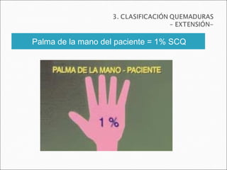 Palma de la mano del paciente = 1% SCQ
 