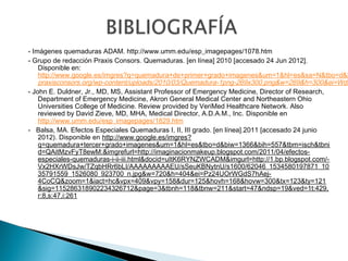 - Imágenes quemaduras ADAM. http://www.umm.edu/esp_imagepages/1078.htm
- Grupo de redacción Praxis Consors. Quemaduras. [en línea] 2010 [accesado 24 Jun 2012].
    Disponible en:
    http://www.google.es/imgres?q=quemadura+de+primer+grado+imagenes&um=1&hl=es&sa=N&tbo=d&b
    praxisconsors.org/wp-content/uploads/2010/03/Quemadura-1png-269x300.png&w=269&h=300&ei=Wdi
- John E. Duldner, Jr., MD, MS, Assistant Professor of Emergency Medicine, Director of Research,
    Department of Emergency Medicine, Akron General Medical Center and Northeastern Ohio
    Universities College of Medicine. Review provided by VeriMed Healthcare Network. Also
    reviewed by David Zieve, MD, MHA, Medical Director, A.D.A.M., Inc. Disponible en
    http://www.umm.edu/esp_imagepages/1829.htm
- Balsa, MA. Efectos Especiales Quemaduras I, II, III grado. [en línea].2011 [accesado 24 junio
    2012). Disponible en http://www.google.es/imgres?
    q=quemadura+tercer+grado+imagenes&um=1&hl=es&tbo=d&biw=1366&bih=557&tbm=isch&tbni
    d=QAitMzvFyT8ewM:&imgrefurl=http://imaginacionmakeup.blogspot.com/2011/04/efectos-
    especiales-quemaduras-i-ii-iii.html&docid=uItK6RYNZWCADM&imgurl=http://1.bp.blogspot.com/-
    Vx2HXrWDsJw/TZqbHRr6bLI/AAAAAAAAAEU/sSeuKBNytnU/s1600/62046_1534580197871_10
    35791559_1526080_923700_n.jpg&w=720&h=404&ei=Pz24UOrWGdS7hAej-
    4CoCQ&zoom=1&iact=hc&vpx=409&vpy=158&dur=125&hovh=168&hovw=300&tx=123&ty=121
    &sig=115286318902234326712&page=3&tbnh=118&tbnw=211&start=47&ndsp=19&ved=1t:429,
    r:8,s:47,i:261
 
