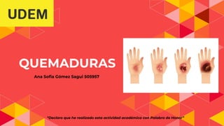 QUEMADURAS
Ana Soﬁa Gómez Sagui 505957
“Declaro que he realizado esta actividad académica con Palabra de Honor”
 