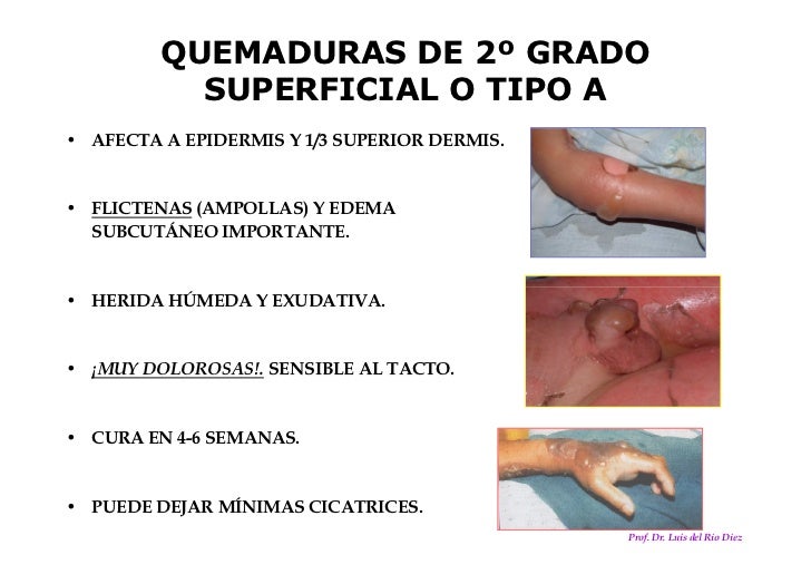 Quemaduras catedra de clinica quirurgica