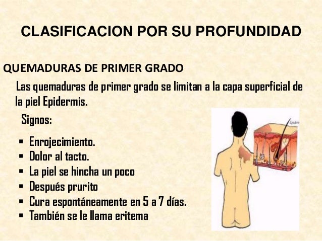 Quemaduras, clasificación y cuidados de enfermería