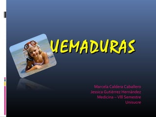 QUEMADURASQUEMADURAS
Marcela Caldera Caballero
Jessica Gutiérrez Hernández
Medicina – Vlll Semestre
Unisucre
 