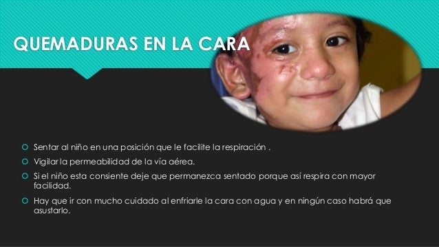 limpiar chinesse sentado en la cara limpiar chinesse sentado en la cara