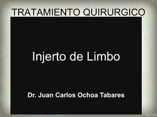 TRATAMIENTO QUIRURGICO
 