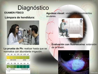 Diagnóstico
Lámpara de hendidura:
Agudeza visual: visión y los movimientos
oculares.
Evaluación con fluoresceína: extensión
de la lesión.La prueba de Ph: realizar hasta que se
normalice con abundante irrigación.
EXAMEN FÍSICO
 