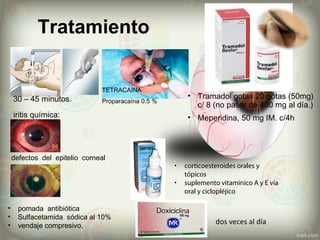 Tratamiento
• corticoesteroides orales y
tópicos
• suplemento vitamínico A y E vía
oral y ciclopléjico
dos veces al día
30 – 45 minutos.
TETRACAINA
Proparacaína 0.5 %
• Tramadol gotas 20 gotas (50mg)
c/ 8 (no pasar de 400 mg al día.)
• Meperidina, 50 mg IM. c/4hiritis química:
defectos del epitelio corneal
• pomada antibiótica
• Sulfacetamida sódica al 10%
• vendaje compresivo.
 