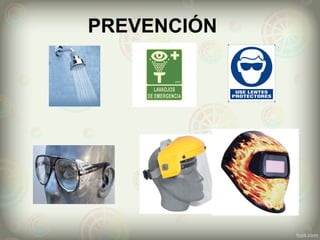 PREVENCIÓN
 