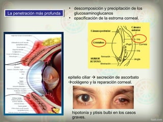 hipotonía y ptisis bulbi en los casos
graves.
La penetración más profundaLa penetración más profunda
• descomposición y precipitación de los
glucosaminoglucanos
• opacificación de la estroma corneal.
epitelio ciliar  secreción de ascorbato
colágeno y la reparación corneal.
 