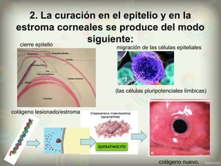 2. La curación en el epitelio y en la
estroma corneales se produce del modo
siguiente:
migración de las células epiteliales
cierre epitelio
(las células pluripotenciales límbicas)
colágeno lesionado/estroma
colágeno nuevo.
 