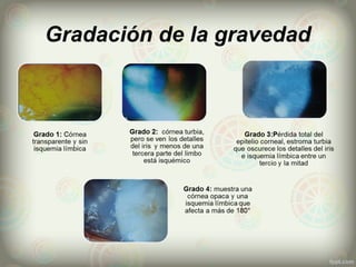 Gradación de la gravedad
 