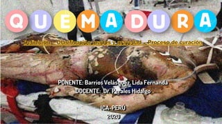 PONENTE: Barrios Velásquez, Lida Fernanda
DOCENTE: Dr. Perales Hidalgo
ICA-PERÚ
2020
 
