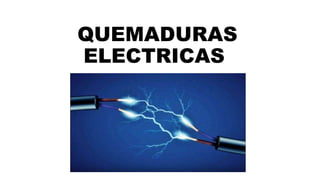 QUEMADURAS
ELECTRICAS
 