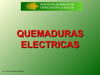 QUEMADURAS
                      ELECTRICAS

Tec. Quimico Sebastian Merlassino
 