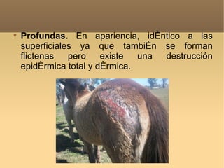 
    Profundas. En apariencia, idéntico a las
    superficiales ya que también se forman
    flictenas   pero    existe  una destrucción
    epidérmica total y dérmica.
 