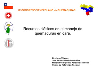 Recursos clásicos en el manejo de quemaduras en cara. Dr. Jorge Villegas Jefe de Servicio de Quemados Hospital de Urgencia Asistencia Pública Centro de Referencia Nacional IX CONGRESO VENEZOLANO de QUEMADURAS 
