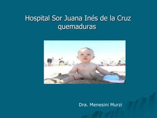 Hospital Sor Juana Inés de la Cruz
           quemaduras




                 Dra. Menesini Murzi
 
