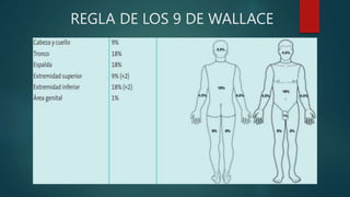 REGLA DE LOS 9 DE WALLACE
 