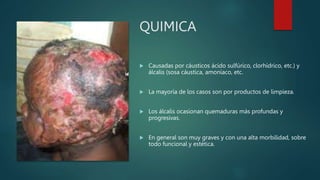 QUIMICA
 Causadas por cáusticos ácido sulfúrico, clorhídrico, etc.) y
álcalis (sosa cáustica, amoníaco, etc.
 La mayoría de los casos son por productos de limpieza.
 Los álcalis ocasionan quemaduras más profundas y
progresivas.
 En general son muy graves y con una alta morbilidad, sobre
todo funcional y estética.
 