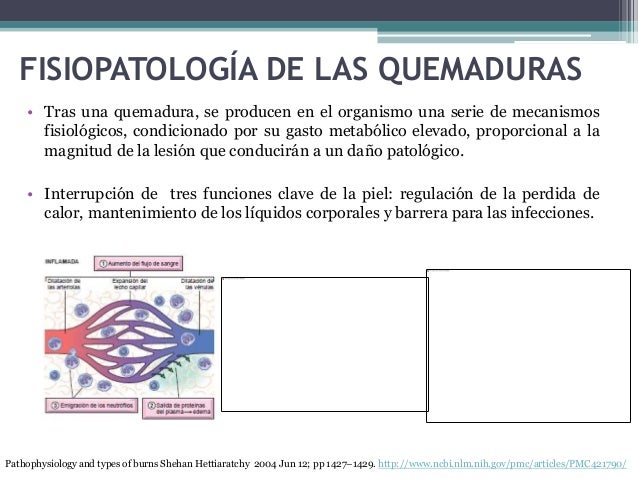 Quemaduras