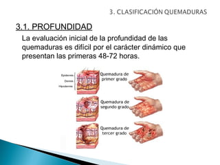 3.1. PROFUNDIDAD
 La evaluación inicial de la profundidad de las
 quemaduras es difícil por el carácter dinámico que
 presentan las primeras 48-72 horas.
 
