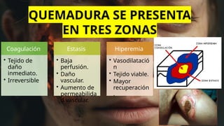 QUEMADURA SE PRESENTA
EN TRES ZONAS
Coagulación
• Tejido de
daño
inmediato.
• Irreversible
Estasis
• Baja
perfusión.
• Daño
vascular.
• Aumento de
permeabilida
d vascular.
Hiperemia
• Vasodilatació
n
• Tejido viable.
• Mayor
recuperación
.
 