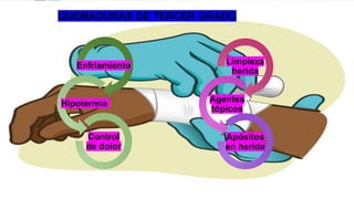 QUEMADURAS DE TERCER GRADO
Enfriamiento
Hipotermia
Control
de dolor
Limpieza
herida
Agentes
tópicos
Apósitos
en herida
 