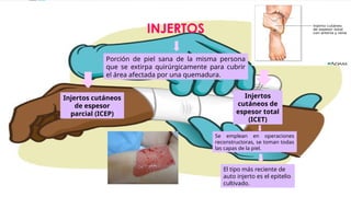 INJERTOS
Porción de piel sana de la misma persona
que se extirpa quirúrgicamente para cubrir
el área afectada por una quemadura.
Injertos cutáneos
de espesor
parcial (ICEP)
Injertos
cutáneos de
espesor total
(ICET)
Se emplean en operaciones
reconstructoras, se toman todas
las capas de la piel.
El tipo más reciente de
auto injerto es el epitelio
cultivado.
 