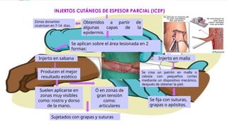 INJERTOS CUTÁNEOS DE ESPESOR PARCIAL (ICEP)
Obtenidos a partir de
algunas capas de la
epidermis.
Zonas donantes
cicatrizan en 7-14 días.
Se aplican sobre el área lesionada en 2
formas:
Injerto en sabana Injerto en malla
Producen el mejor
resultado estético
Suelen aplicarse en
zonas muy visibles
como: rostro y dorso
de la mano.
Ó en zonas de
gran tensión
como:
articulares
Sujetados con grapas y suturas
Se crea un patrón en malla o
celosía con pequeños cortes
mediante un dispositivo mecánico,
después de obtener la piel.
Se fija con suturas,
grapas o apósitos.
 