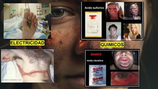 ELECTRICIDAD QUIMICOS
 