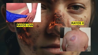 RAYOS UVA
RAYOS X
 