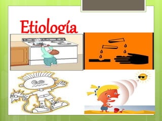 Etiología
 