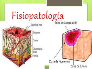 Fisiopatología
 