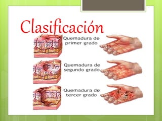 Clasificación
 