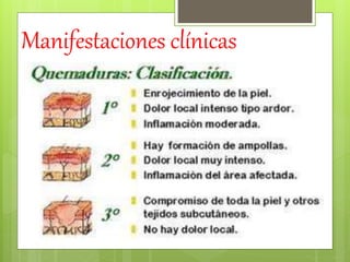 Manifestaciones clínicas
 