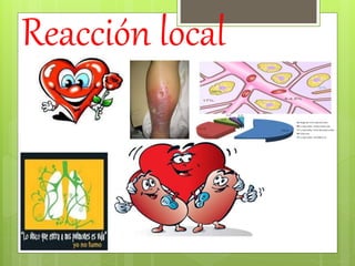 Reacción local
 