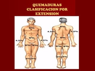 QUEMADURAS
CLASIFICACION POR
EXTENSION
 