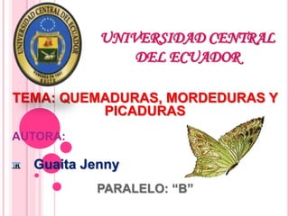 UNIVERSIDAD CENTRAL
DEL ECUADOR
TEMA: QUEMADURAS, MORDEDURAS Y
PICADURAS
AUTORA:
Guaita Jenny
PARALELO: “B”
 