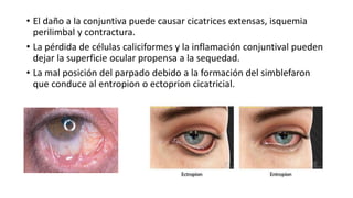 Quemaduras oculares [autoguardado] | PPTX