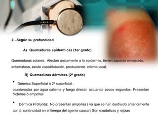 2.- Según su profundidad
A) Quemaduras epidérmicas (1er grado)
Quemaduras solares. Afectan únicamente a la epidermis, tienen aspecto enrojecido,
eritematoso, existe vasodilatación, produciendo edema local.
B) Quemaduras dérmicas (2º grado)
• Dérmica Superficial ó 2º superficial .
ocasionadas por agua caliente y fuego directo actuando pocos segundos. Presentan
flictenas ó ampollas
• Dérmica Profunda: No presentan ampollas ( ya que se han destruido anteriormente
por la continuidad en el tiempo del agente causal) Son exudativas y rojizas
 
