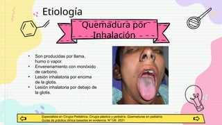 quemaduras pediatria.pptx laminas de quemaduras en pediatria | PPTX
