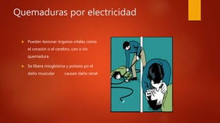 Quemaduras por electricidad
 Pueden lesionar órganos vitales como
el corazón o el cerebro, con o sin
quemadura.
 Se libera mioglobina y potasio po el
daño muscular causan daño renal
 