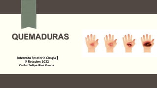 QUEMADURAS
Internado Rotatorio Cirugía
IV Rotación 2022
Carlos Felipe Ríos García
 