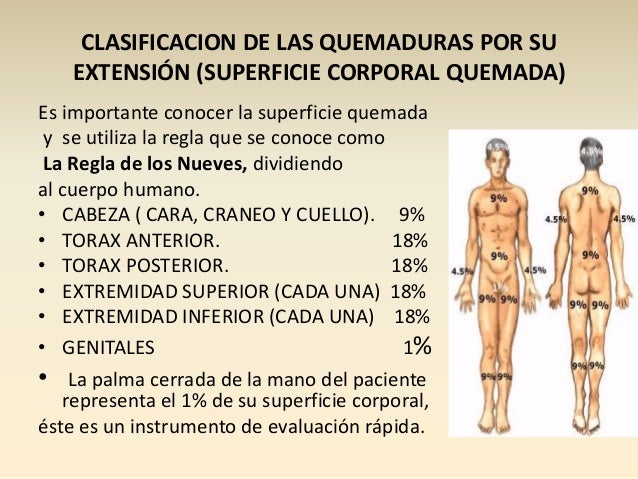 Quemaduras presentacion