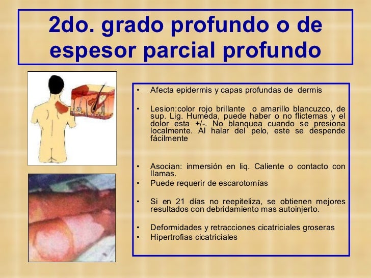 Las manchas de pigmento en la piel de las personas