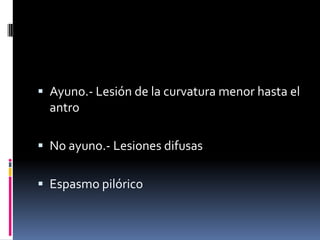  Ayuno.- Lesión de la curvatura menor hasta el
antro
 No ayuno.- Lesiones difusas
 Espasmo pilórico
 