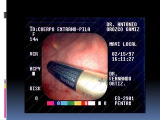 Quemaduras y cuerpos extraños