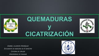 QUEMADURAS
y
CICATRIZACIÓN
GABRIEL CALDERÓN HENRÍQUEZ
ESTUDIANTE DE MEDICINA DE X SEMESTRE
CATEDRA DE CIRUGÍA
UNIVERSIDAD DE PANAMÁ
 