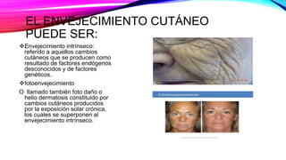 EL ENVEJECIMIENTO CUTÁNEO
PUEDE SER:
Envejecimiento intrínseco:
referido a aquellos cambios
cutáneos que se producen como
resultado de factores endógenos
desconocidos y de factores
genéticos.
fotoenvejecimiento
O llamado también foto daño o
helio dermatosis constituido por
cambios cutáneos producidos
por la exposición solar crónica,
los cuales se superponen al
envejecimiento intrínseco.
 
