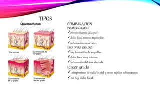 TIPOS
COMPARACION
PRIMER GRADO
enrojecimiento dela piel
dolor local intenso tipo ardor.
inflamación moderada.
SEGUNDO GRADO
hay formación de ampollas.
dolor local muy intenso.
inflamación del área afectada.
tercer grado
compromiso de toda la piel y otros tejidos subcutáneos.
no hay dolor local.
 